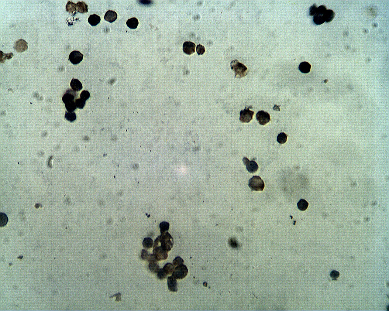 Staining of Hep G2 cells with PCSK9 antibody (Cat. No. X2404P) at 2 µg/ml.